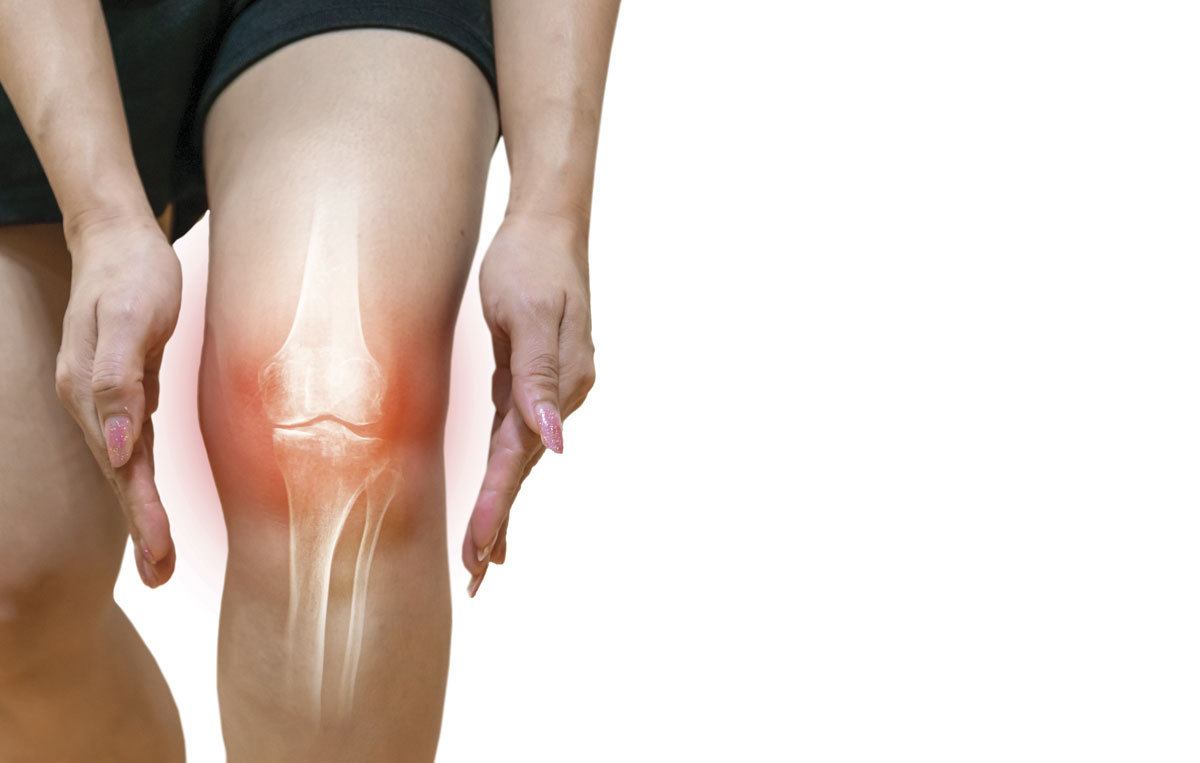 knee arthritis mathew saturnino chiropractor vaughan woodbridge